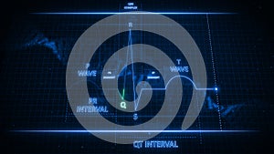 Q Wave from Electrocardiogram Wave or ECG or EKG