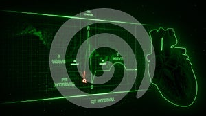 Q Wave from Electrocardiogram Wave or ECG or EKG