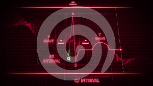 Q Wave from Electrocardiogram Wave or ECG or EKG