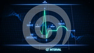 QT Interval of Electrocardiogram Wave or ECG or EKG