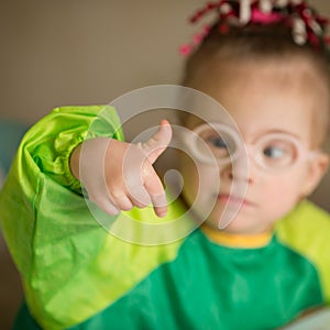 Quite a nice little girl with Down`s syndrome photo
