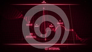 R Wave from Electrocardiogram Wave or ECG or EKG