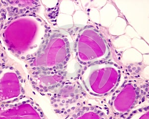 Rabbit thyroid gland. Periodic acidâ€“Schiff PAS method