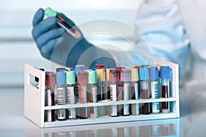 Rack with blood test tubes in clinical lab