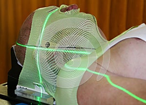 Radiation Therapy