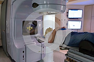 Radiation Therapy Treatment