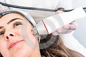 Radio frequency microneedling machine handpiece on the cheek of a woman`s face during a beauty skin tightening treatment