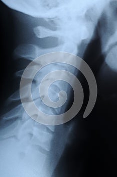 Radiograph of human neck