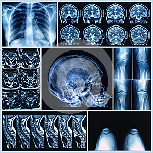 Radiography of Human Bones photo