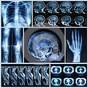 Radiography of Human Bones photo