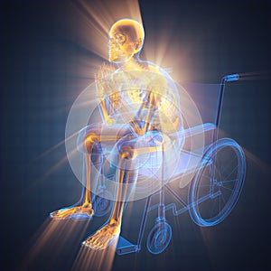 Radiography of man in wheelchair