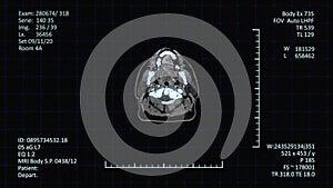 Radiologic examinations images