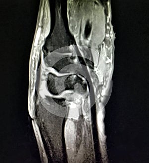 Radiological mri exam wrist anatomy pathology