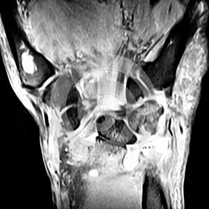 Radiological mri exam wrist anatomy pathology