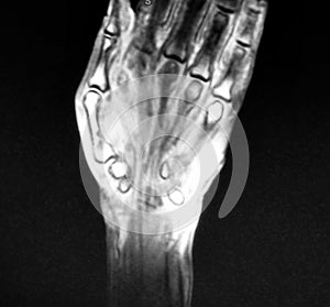 Radiological mri exam wrist anatomy pathology