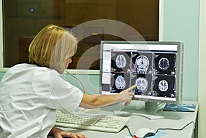 Radiologist analyzing x-ray image