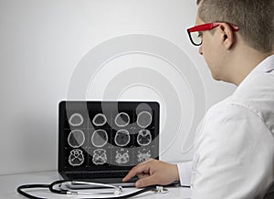 Radiologist doctor examines the result of a computed tomography of the brain on a computer monitor. Diagnosis of neurological