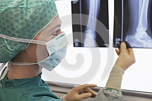 Radiologist Examining Xray Of Leg photo