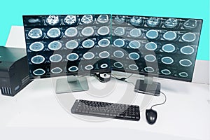 Radiologist x-ray examination room Reading the CT scan brain of the patient on the LCD morniter