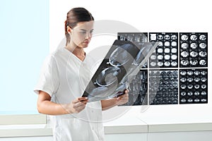 Radiologist woman checking xray, healthcare, medical