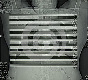 Radiology, computed tomography of chest