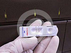 Ramsay Hunt Syndrome (RHS) testing with rapid test cassette photo