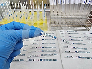 Rapid Influenza test for virus biochemical research laboratory photo