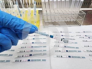 Rapid Influenza test for virus biochemical research laboratory photo