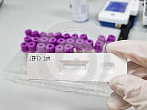A rapid Kit for detection of IgM against Leptospira in human.