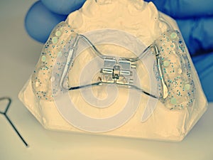 Rapid palatal expander set on teeth cast