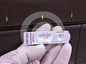 Rapid test cassette for SARS-COV-2, Covid-19 Omicron Subvariant (BA-4 and BA-5) antigen test at medical laboratory.