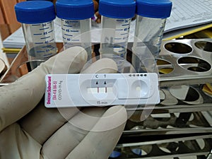 Rapid test kit for Monkeypox virus