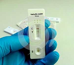 Rapid test for Varicella zoster virus or VZV test.