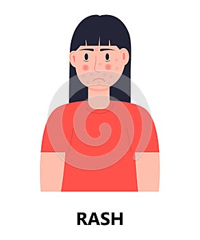 Rash icon vector. Unhappy girl with rash and acne on her face. Woman is infected by rubella, measles. Allergy, eczema