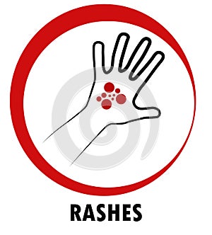 Rashes, symbol of disease, a hand with a rash in a ring, pictogram