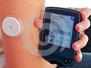 Reading a glucose  level with device for continuous glucose monitoring in blood Ã¢â¬â CGM. photo