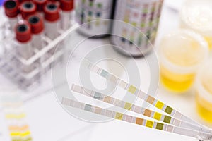 Reagent strips used in urinalysis to analyze Leukocytes, Urobilinogen, Bilirubin, Blood, Nitrite, pH, Density, Protein, Glucose