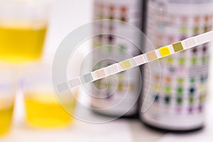 Reagent strips used in urinalysis to analyze Leukocytes, Urobilinogen, Bilirubin, Blood, Nitrite, pH, Density, Protein, Glucose