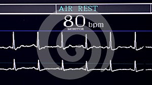 Real Cardiogram. Working cardiograph in a cardiology hospital.