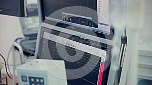 Real Cardiogram. Working cardiograph in a cardiology hospital. Slider shoot.