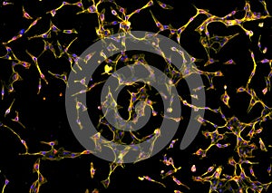 Real fluorescence microscopic view of human fibroblasts