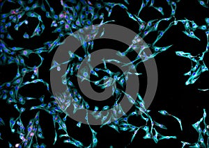 Real fluorescence microscopic view of human fibroblasts photo