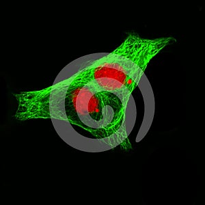 Real fluorescence microscopic view of human neuroblastoma cells