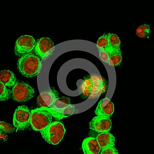 Real fluorescence microscopic view of human neuroblastoma cells photo