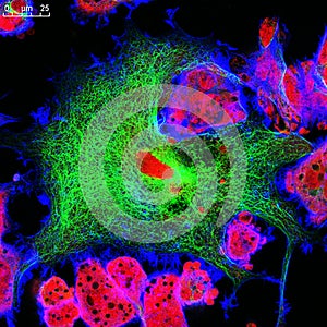 Real fluorescence microscopic view of mice neuroblastoma cell line photo