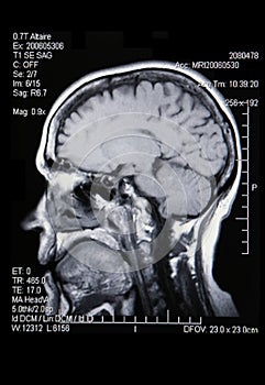 A real MRI/ MRA