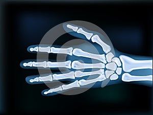 Realistic 2D X-ray Hand Dark Medical Image