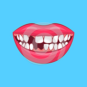 Realistic Detailed 3d Dental Problem on a Blue. Vector