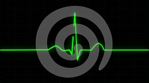 Realistic Heart Pulse Monitor Animation