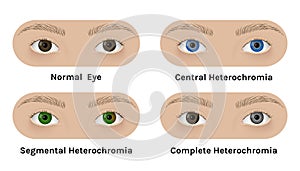 Realistic human eyes with heterochromia vector illustration design